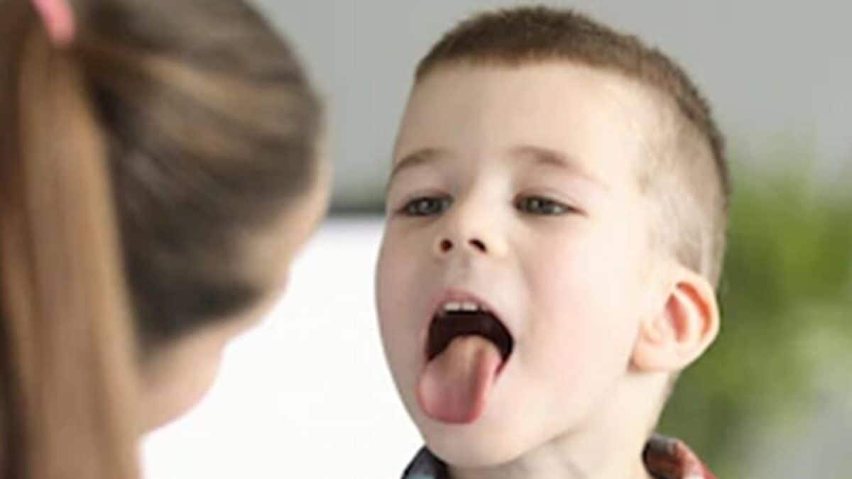 Know Everything About Adenoiditis and How Can It Affect You