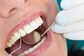 6 Oral Health Tips for Older Adults