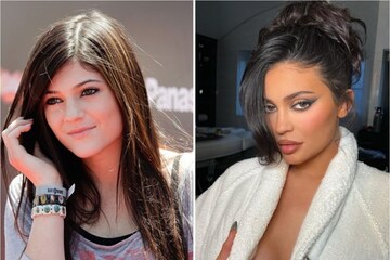 Kylie Jenner Denies Having Undergone 'Extensive Plastic Surgery