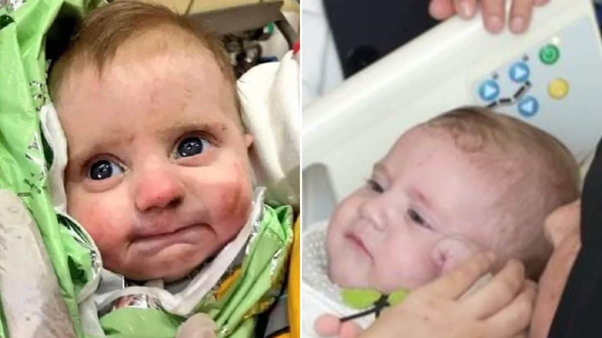 '54 Days Apart and a DNA Test': 'Miracle Baby' Rescued in Turkey Earthquake Reunited with Mother - Vimarsana News