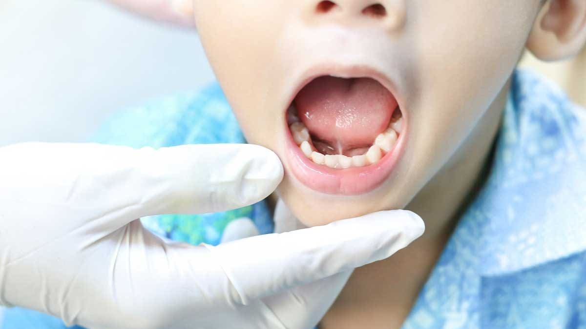 5 Diseases Doctors Can Diagnose After Looking at the Tongue of Patient