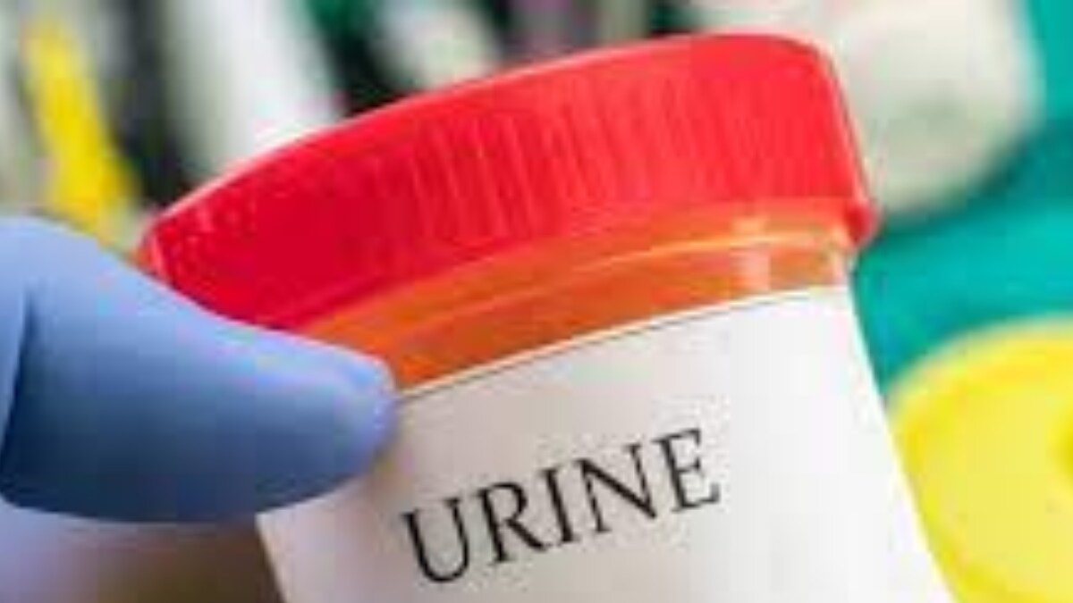 Protein In Urine Is A Sign Of Kidney Damage Check Symptoms Causes And 