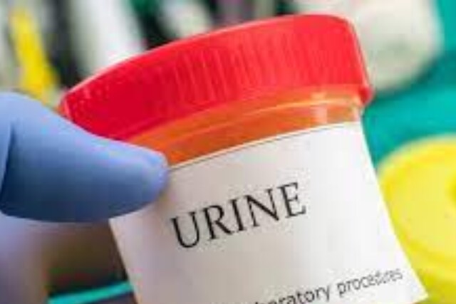 Protein In Urine Is A Sign Of Kidney Damage; Check Symptoms, Causes And ...