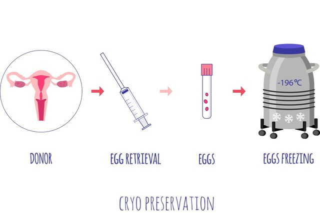 Egg Freezing: The Pros, Cons, and Everything You Need to Know - News18