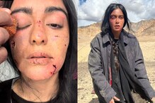 Adah Sharma's 'Wounded' Photos From The Kerala Story's Afghanistan Shoot Will Shock You