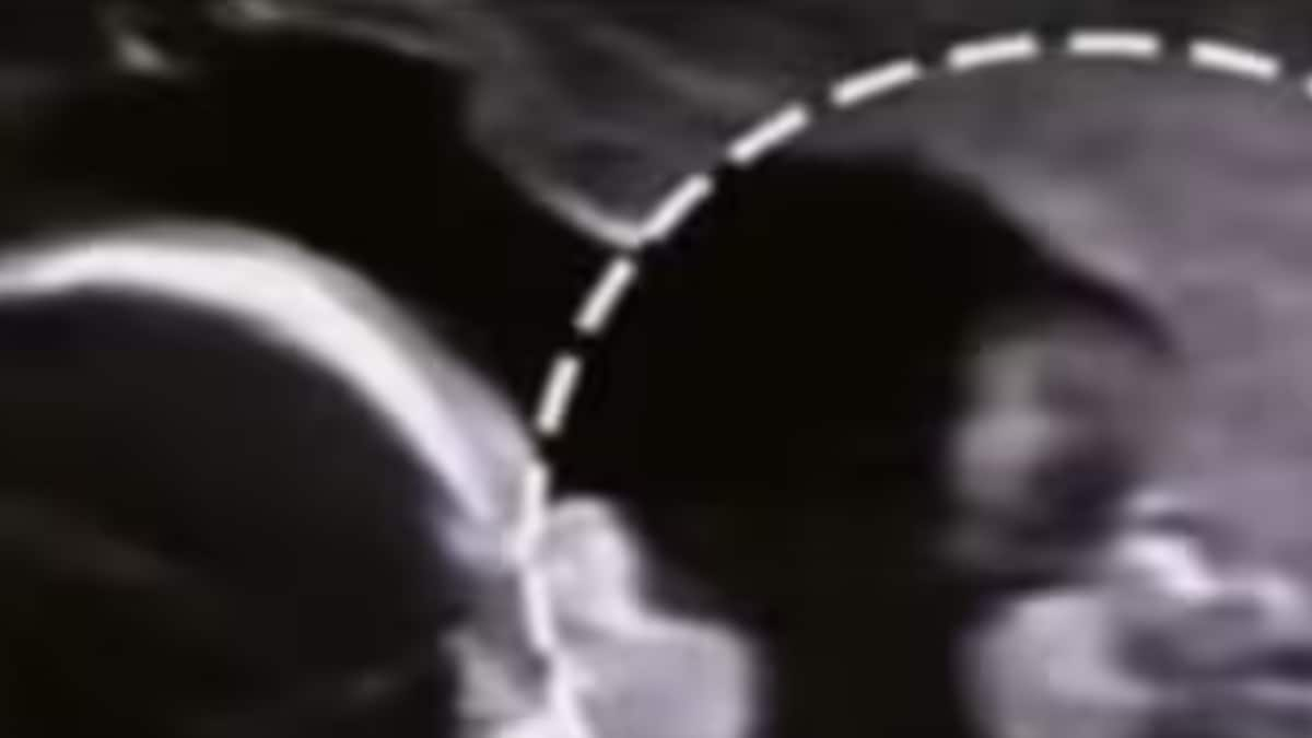 In Ultrasound Footage, Baby Pokes Mom's Belly; Internet Is Stunned