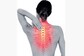 6 Ways for Women to Improve Bone Density After Menopause