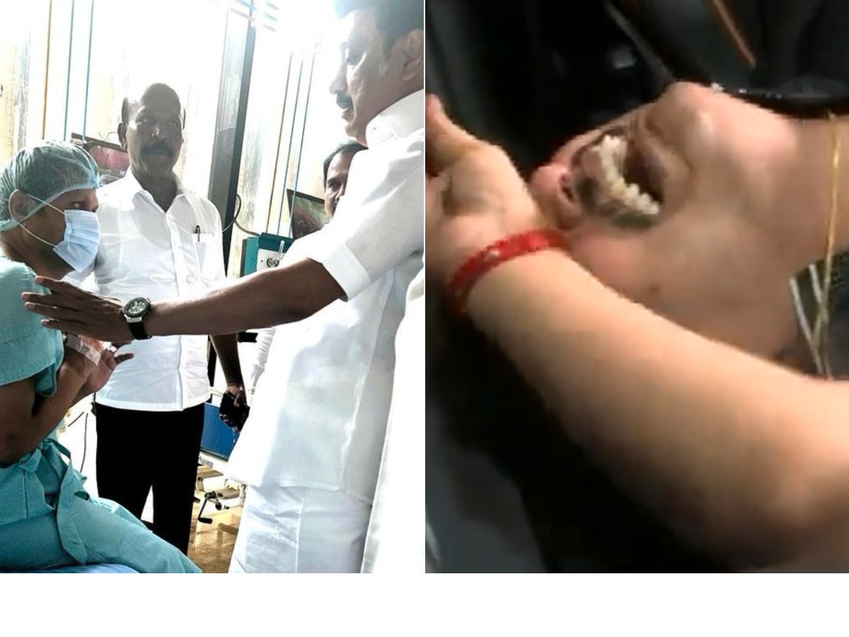 Seen 'Weeping' Post ED Arrest, Tamil Nadu Minister Senthil Balaji Has '3 Blockages in Heart'; High Drama in Chennai