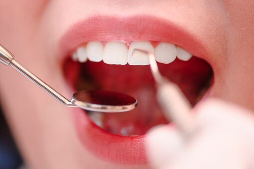 Keep in mind that ongoing bad breath could indicate an underlying dental or medical problem