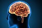Brain Tumours: Everything You Need To Know About the Condition