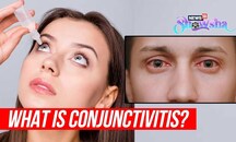 Conjunctivitis Cases On The Rise In Delhi-NCR: What Is Eye Flu? How To Prevent Its Spread