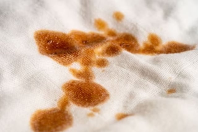 Applying White toothpaste on the stain for a day can remove it from the cloth.