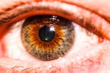 Feel Itchy In The Eyes? You Might Be Suffering From This Infection