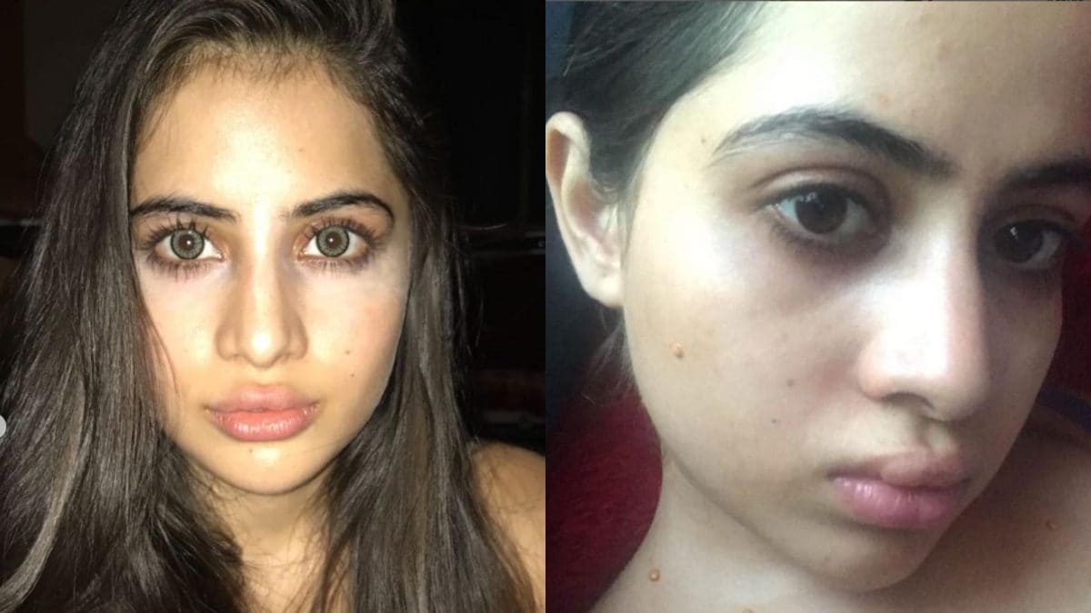 Urfi Javed Defends Fillers, Plastic Surgery, Says ‘Do It Instead of