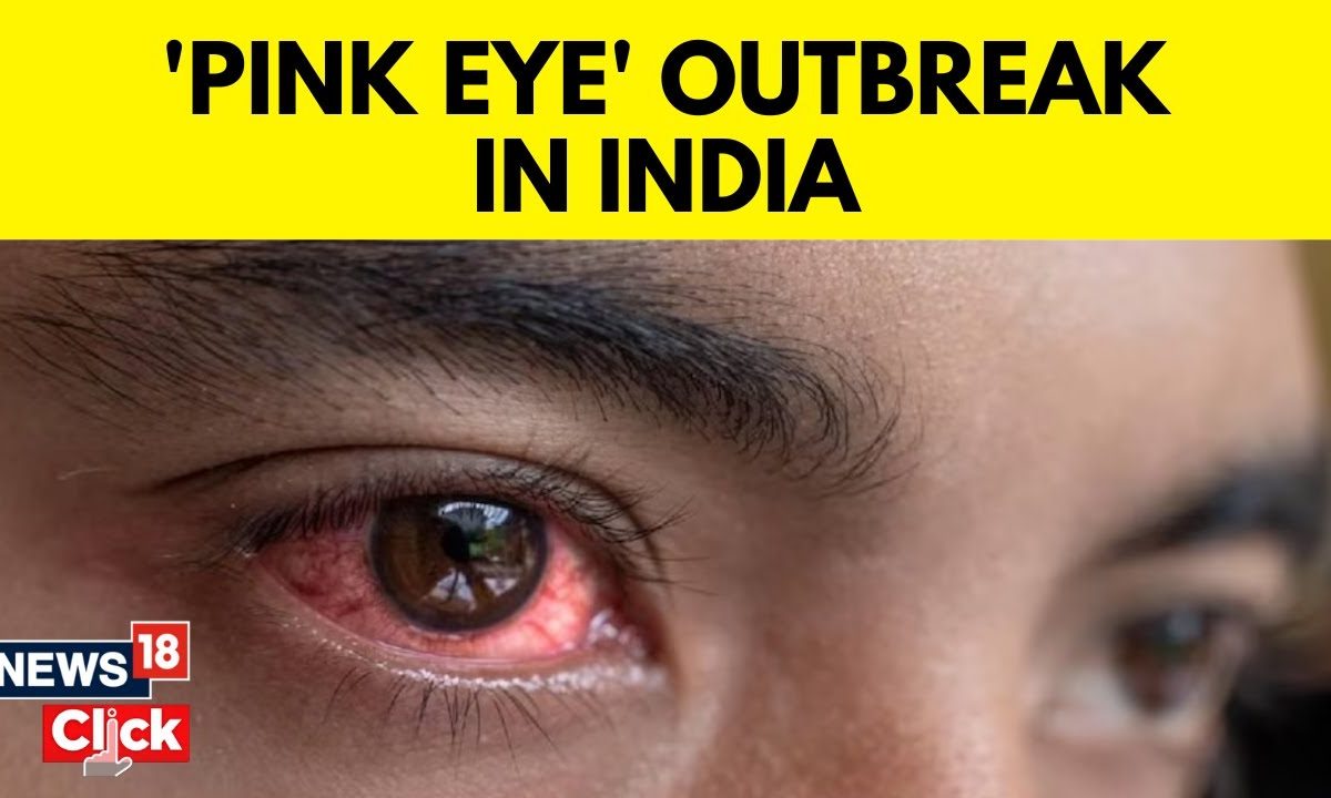 Conjunctivitis In India Pink Eye Outbreak Across India