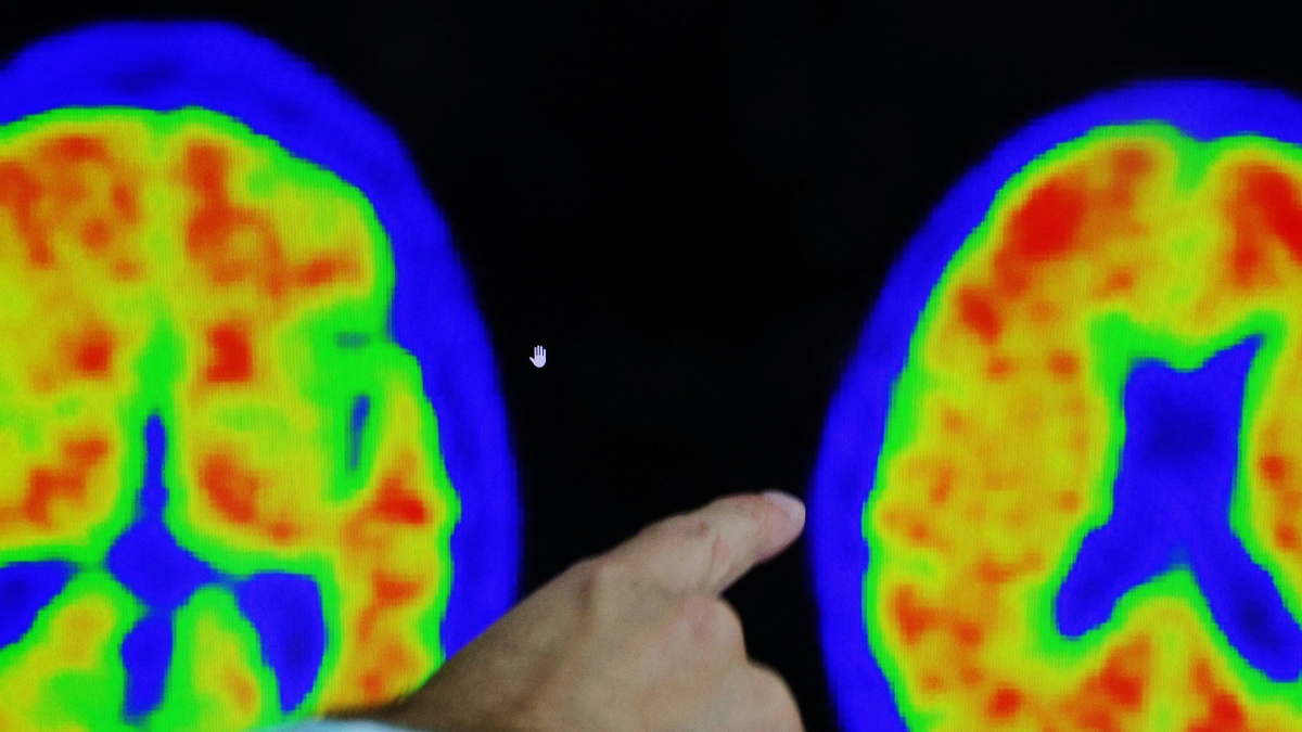 New Study Identifies Gene 'fingerprint' For Brain Ageing, Sheds Light