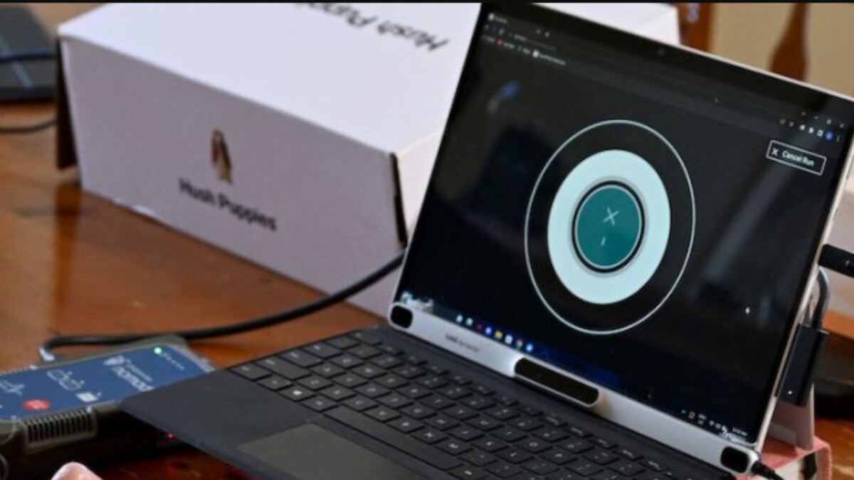 Als Computer Interface ALS Patient Pioneering Brain-computer Connection | Viral News - News18