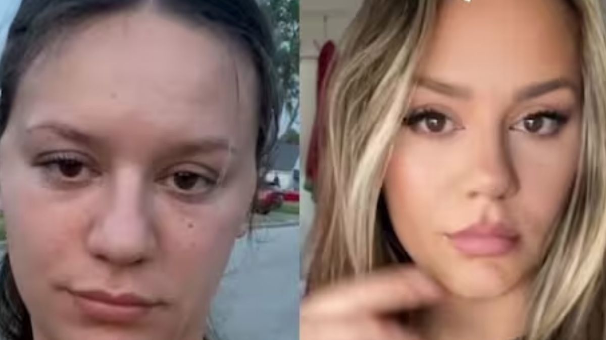 Watch: Canadian Beauty Influencer Stuns Netizens With ‘Face Tape’ Transformation – News18