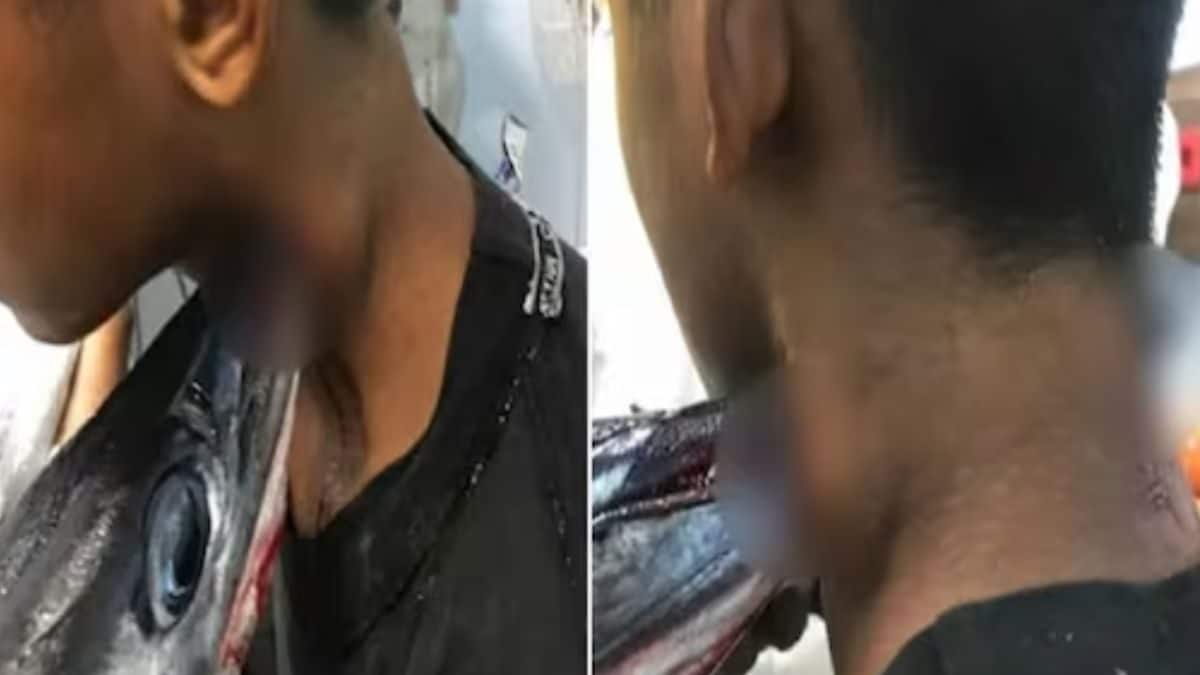 Needlefish Pierces Through Indonesian Teen's Neck On Fishing Trip, Removed After Hours - Vimarsana News