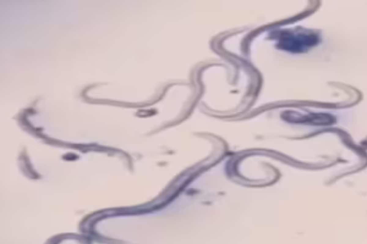 Germs under Nail Microscope | TikTok