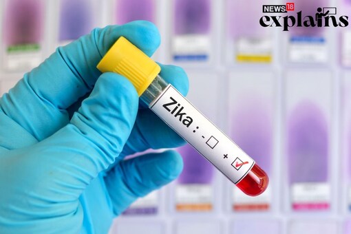 Zika virus is transmitted primarily by Aedes mosquitoes and the symptoms include fever, rash, headache, joint pain and red eyes. (Credits: Shutterstock)