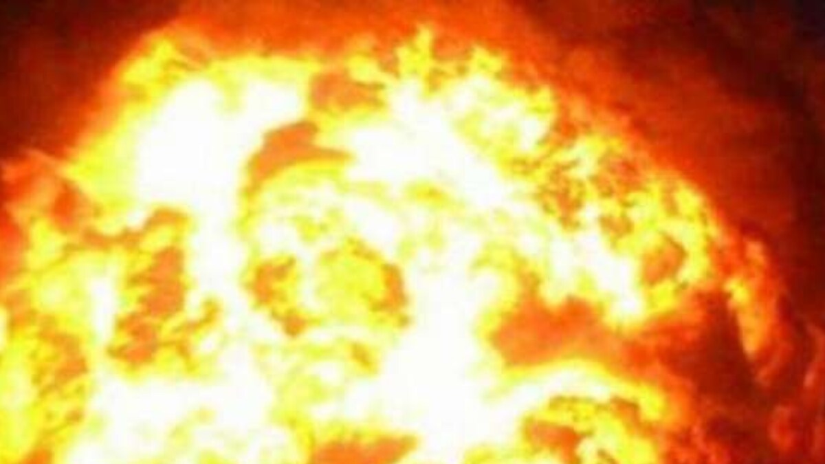 Mumbai: Man Injured in Fire Following Cylinder Blast in Wadala - Vimarsana News