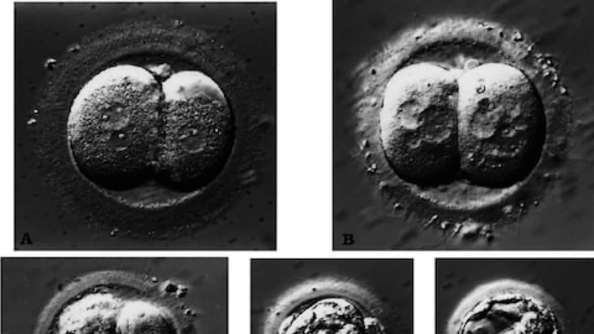 A US Court Ruled That Frozen Embryos Are People, What Does It Mean for the Future of IVF?