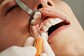 Dental Care For An Aging Population