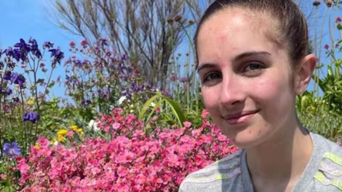 'Feels Like Burning Alive': Woman Describes Her Allergic Skin - Vimarsana News