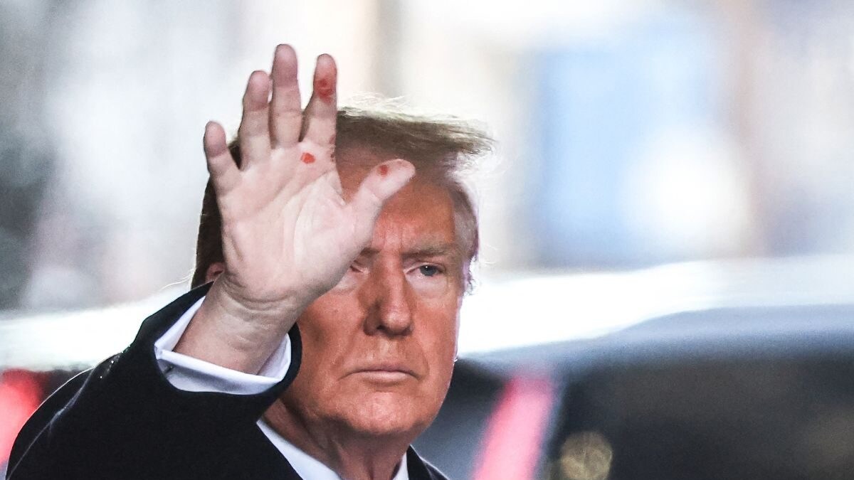 Ketchup Stains or Snow Blisters? 'Red Marks' on Trump's Hand Spark Internet Frenzy, Conspiracy Theories - Vimarsana News