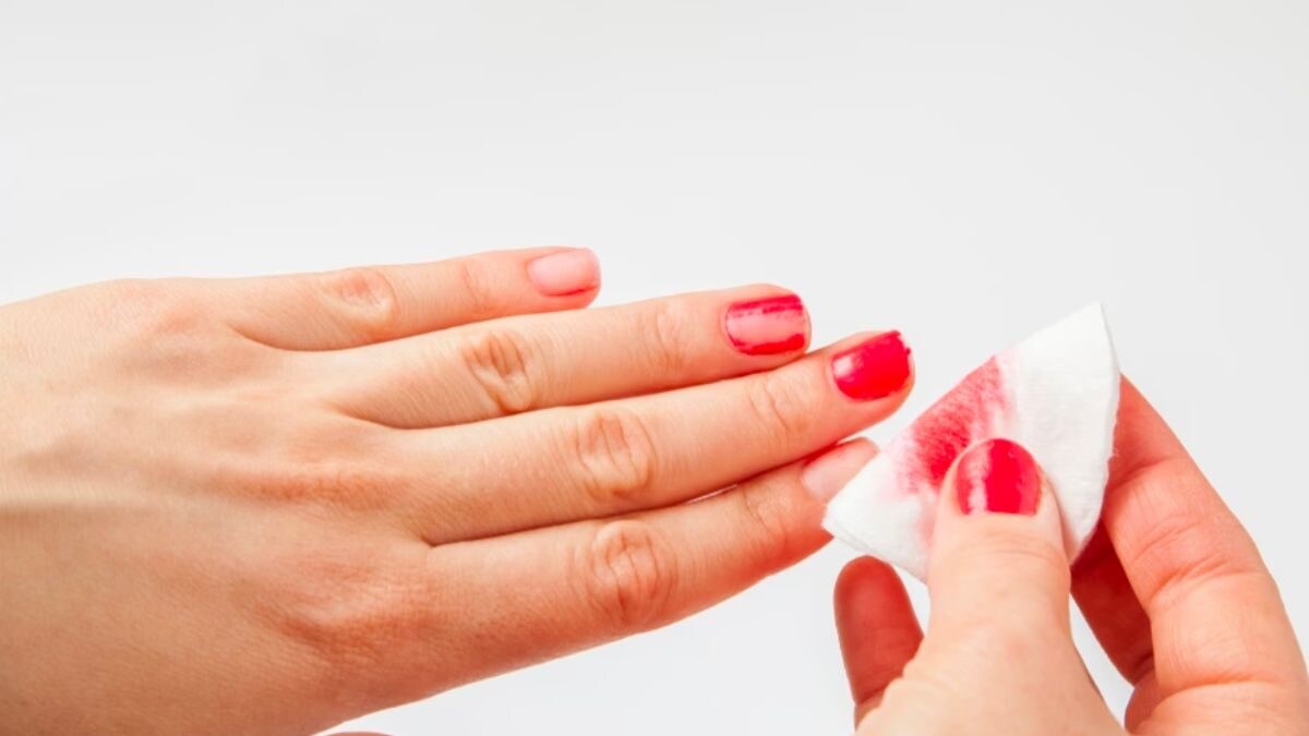 Girl, 14, Suffers ThirdDegree Burns After Using Nail Polish Remover