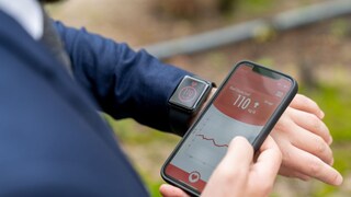 Planning to Buy A Smartwatch That Claims to Measure Your Blood Sugar Levels? Here's Why You Must Think Again - Vimarsana News