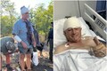 Former International Cricketer Cheats Death Surviving a Horrific Leopard Attack; Bloody Images Emerge