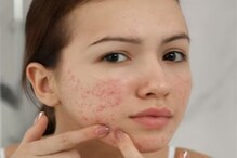 The Impact of Climate Change on Skin: Insights from Leading Cosmetologists