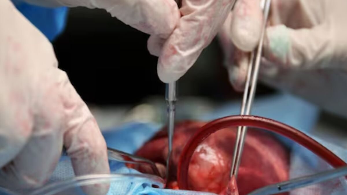 Mumbai Doctors Perform C-Section Under Torchlight, Deliver Dead Boy; Mother Passes Away Hours Later - Vimarsana News