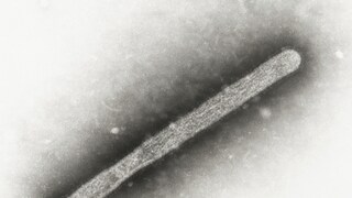 US Reports Second Human Case of Bird Flu Linked To Country's Dairy Cow Outbreak - Vimarsana News