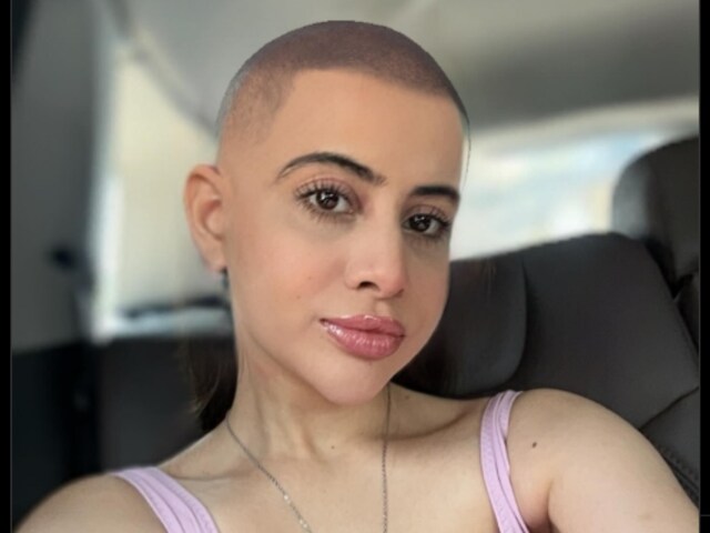 Urfi Javed Goes BALD? Actress Shares Bold Pic With No Hair, Shocked