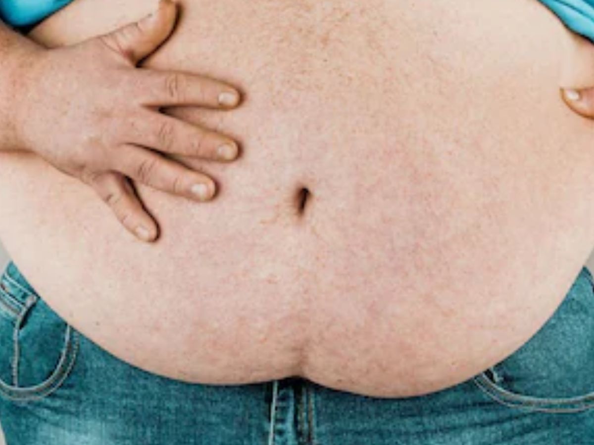 10 Incredible Fat Burning Gummies from Shark Tank: Unveiling Their Benefits