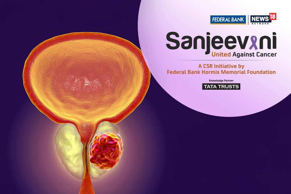 New Prostate Cancer Test May Help Men Avoid Unnecessary Biopsy