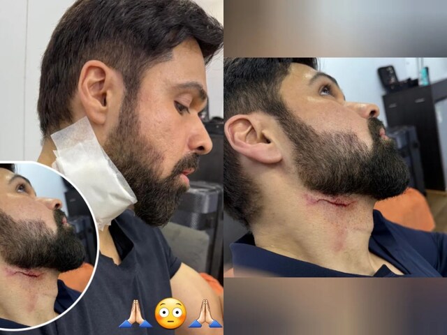 Emraan Hashmi suffers neck injury on Goodachari 2 sets.