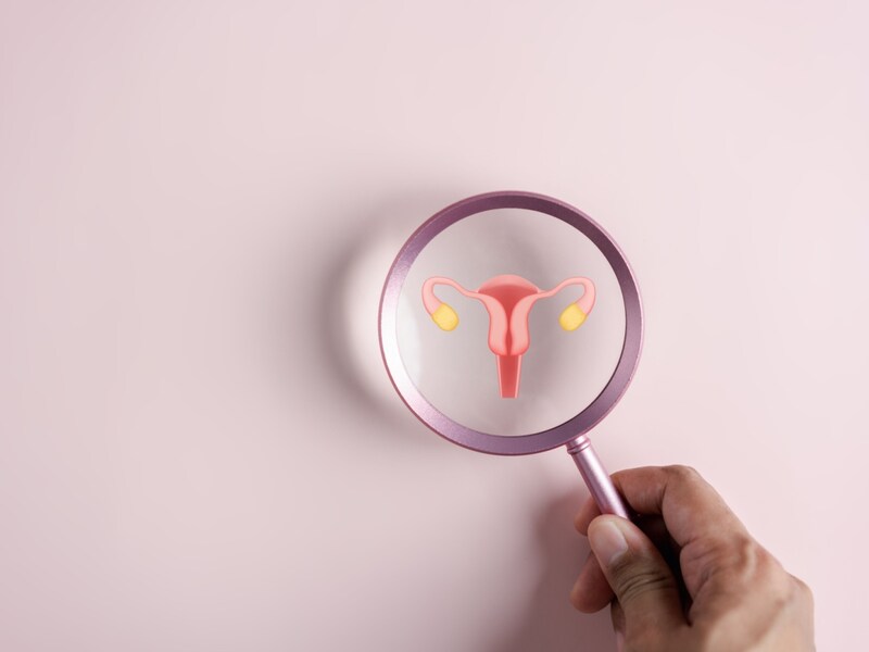 Diminishing ovarian reserve is when the eggs in the ovaries start to decline and there are only fewer eggs left in the ovaries Diminishing ovarian reserve is when the eggs in the ovaries start to decline and there are only fewer eggs left in the ovaries