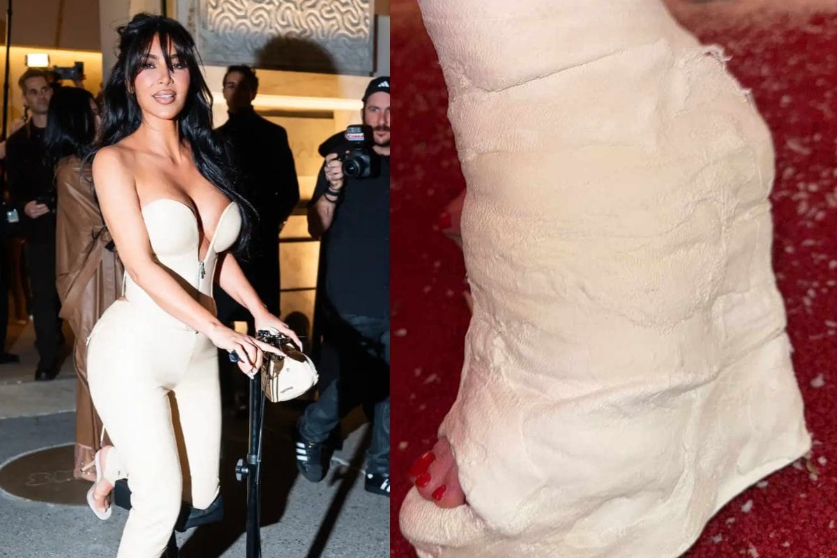 Only Kim Kardashian Can Make An Injured Foot Look Oh-So-Chic