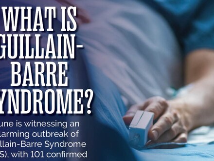 Guillain-Barre Syndrome (News18 Creative)