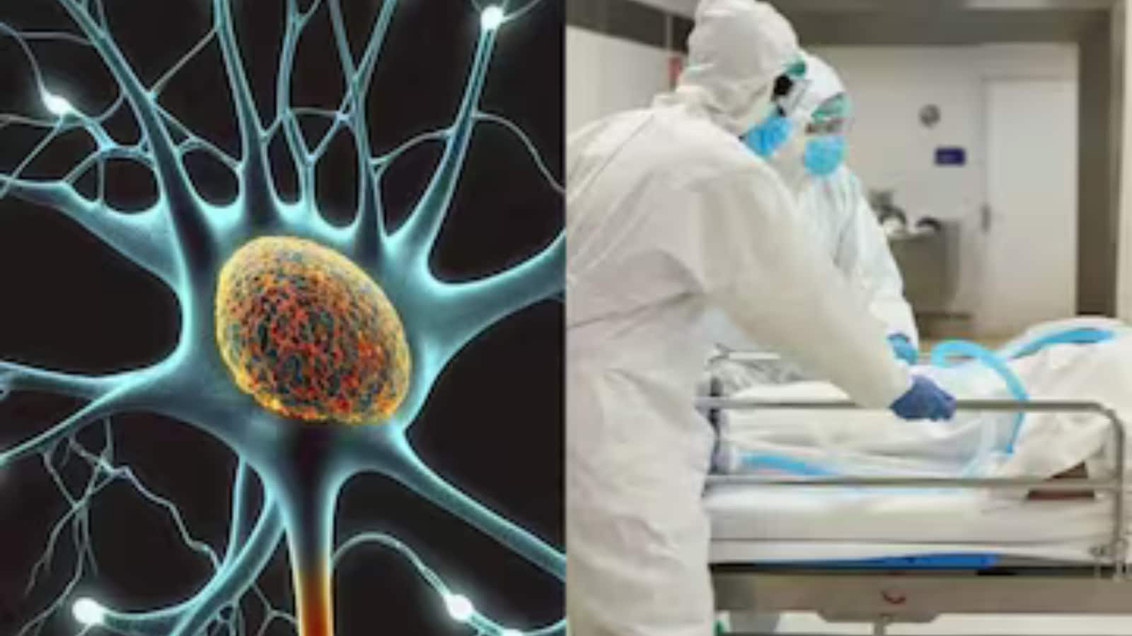 First Death from GBS Virus Reported in Solapur, Maharashtra