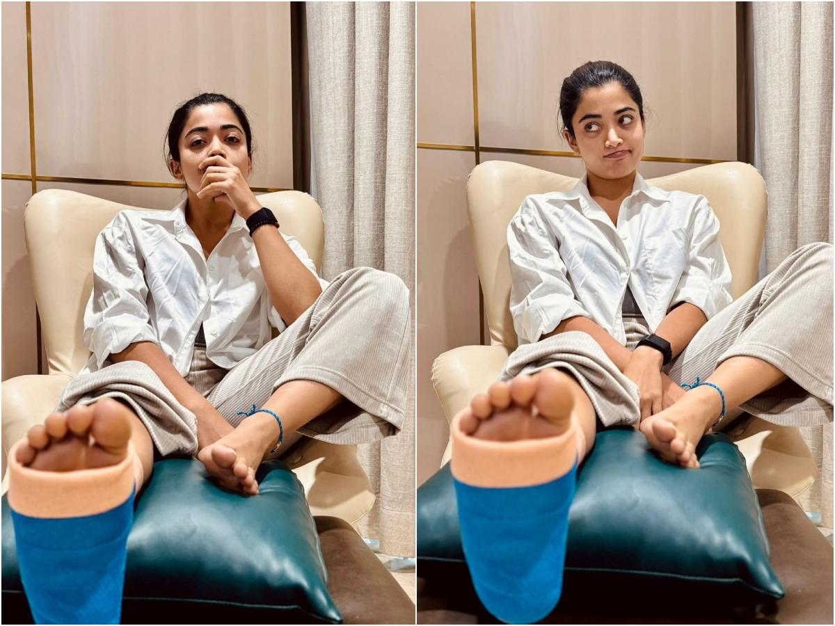 Rashmika Mandanna Shares Update Post Gym Injury, Says She Will 'Hop' Back  To Sets For Thama, Sikandar | PICS - News18