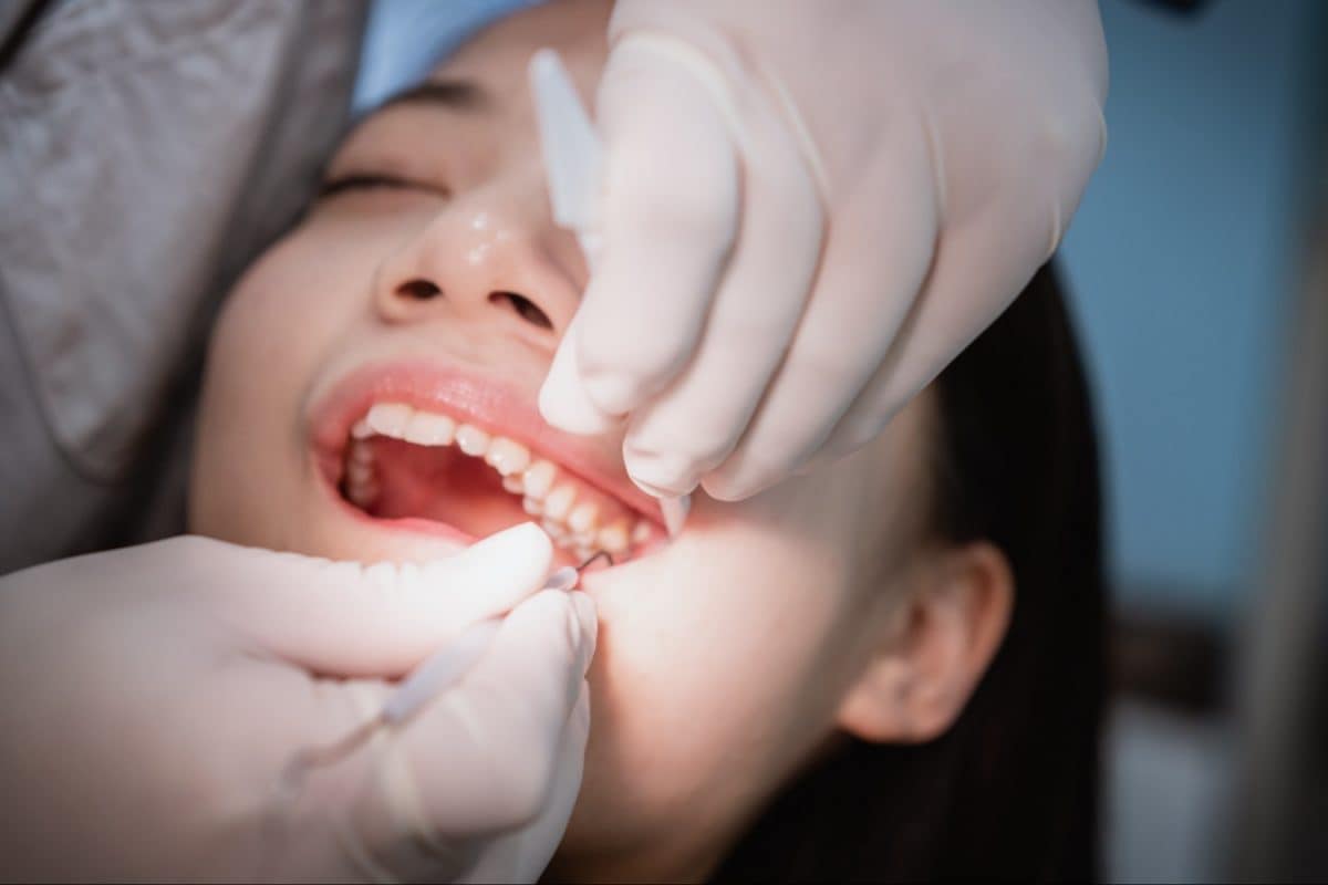 Wisdom Teeth Extraction: Know Some Precautions To Take For A Speedy Recovery