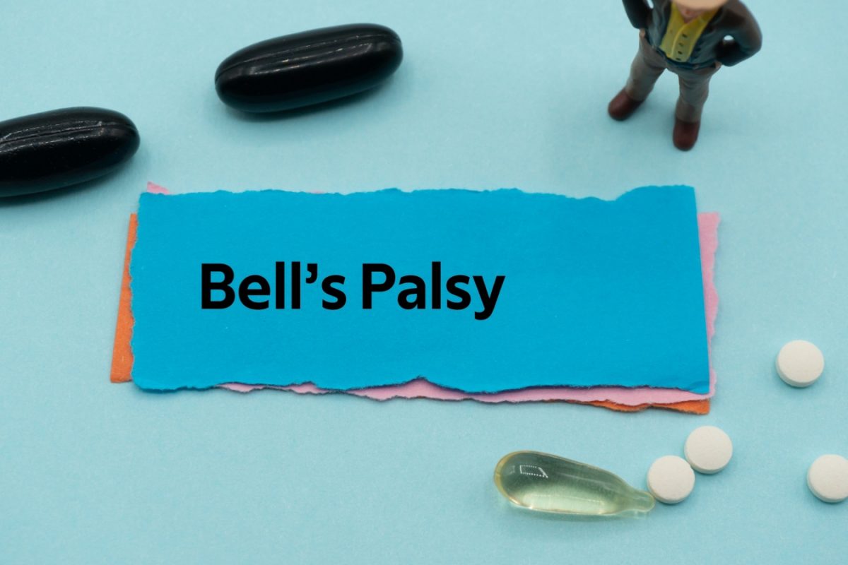 Understanding Bell’s Palsy: Causes, Prevalence and Risk Factors