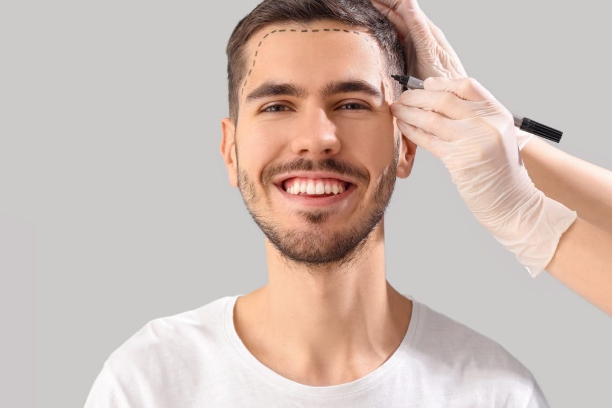 Hair Transplants for Millennials: The Rise of Preventive Restoration