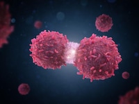 Genetic counselling is crucial for those with family history of ovarian cancer. How Lifestyle Changes And Early Detection Can Help Prevent Ovarian Cancer