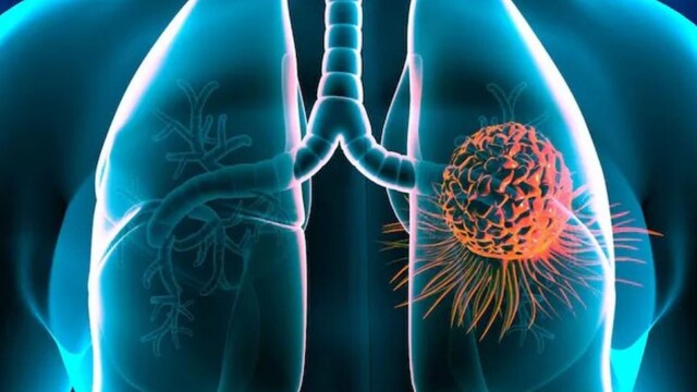 The US Centers for Disease Control and Prevention (CDC) issued precautionary advice to reduce the risk of exposure to Aspergillus fumigatus.(Shutterstock File Photo)